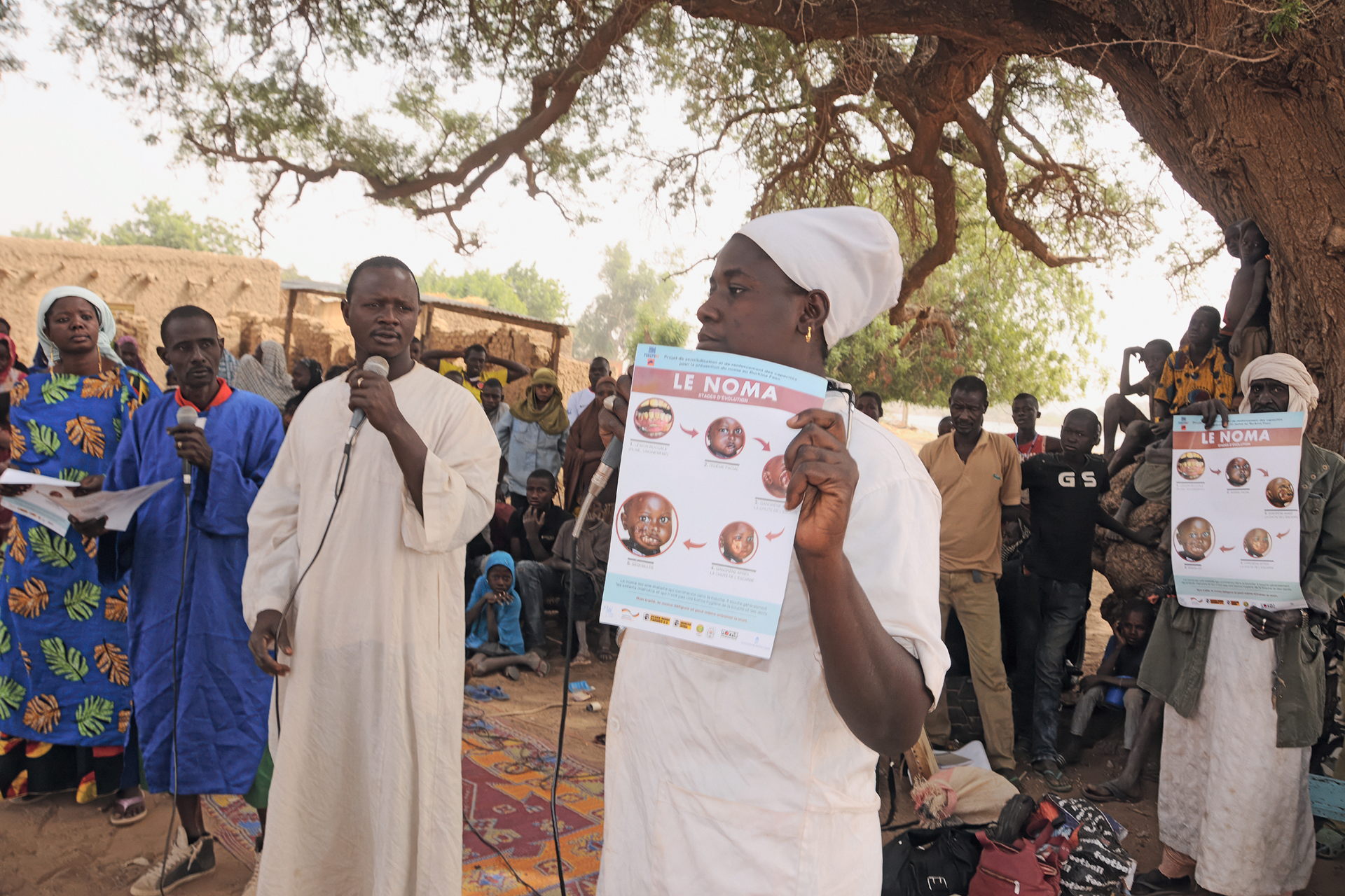 Gesundheitsmitarbeiterin zeigt bei einer Aufklärungskampagne ein Plakat über Noma